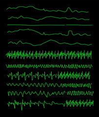 Collection of electrocardiogram lines to indicate the function of the heart. Emphasizing the complexity and beauty of the electrocardiogram and conveying the heart's unstoppable function.