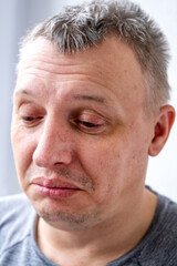 Obraz premium distorted face of sad and grieved very upset person, dissatisfied with his hard fate