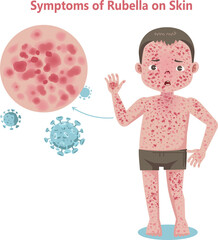 Skin Condition Symptoms of Rubella
