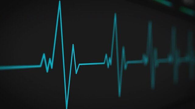 Hospital Monitor Displaying a Moving Pulse Rate Graph, Showing Real-time Heart Activity in a Hospital Ward. Close Up of a Healthcare Technology Monitoring Patient's Vital Signs