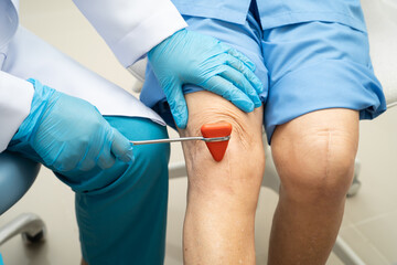 Asian doctor knock on knee reflex nerve for check and treatment senior patient in hospital.