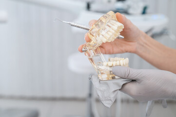 Close up female dentist in stomatologist clinic shows to the patient visually how 
treat caries,...