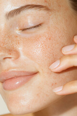 People with acne A close-up of a woman gently touching her glowy, freckled face, showcasing healthy skin and natural beauty.