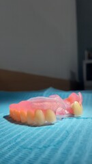 A Partial Denture for upper jaw © apard