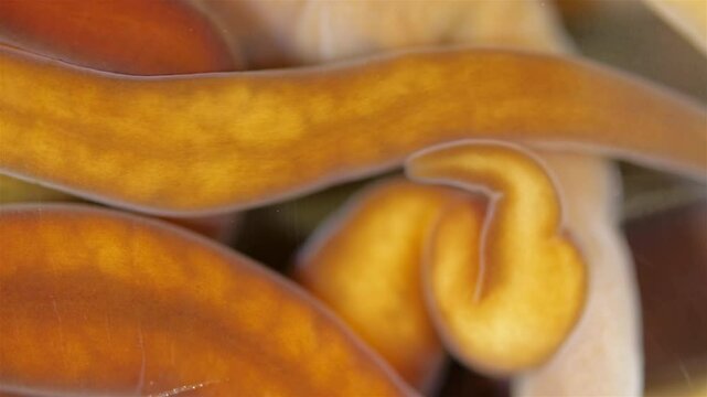 Different Nemertea worms under microscope. Amphiporus lactifloreus, Lineus ruber, Lineus viridis. Predators, tapeworms that secrete large amounts of mucus. White Sea