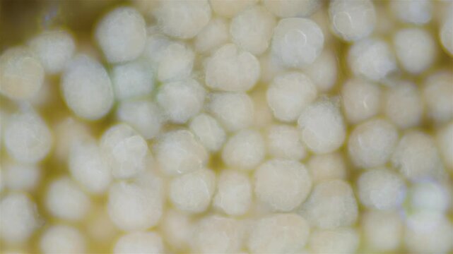 Eggs with developing larvae worm Polydora sp. under microscope, family Spionidae, class Polychaeta. They lay eggs in tubes in which they develop. White Sea.
