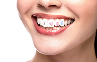 ティースジュエリー　カラフルなパーツをつけた女性の口元