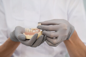 Dentist doctor holds a mannequin jaw model with teeth and implants in his hands in rubber gloves...