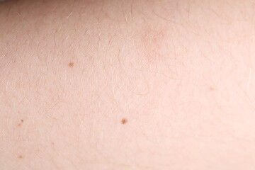 Fototapeta premium Texture of healthy skin as background, closeup