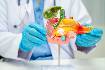 Pancreatitis, pancreatic cancer, Asian doctor with pancreas, gallbladder and bile duct human...