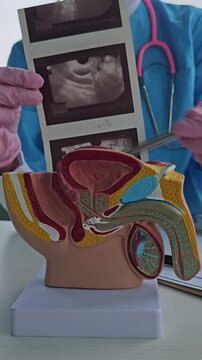 Ultrasound of male genital organs and doctor examines result 