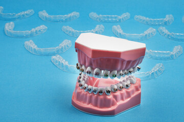 Cosmetic dentistry orthodontics dental metal wire teeth brackets teaching student model....
