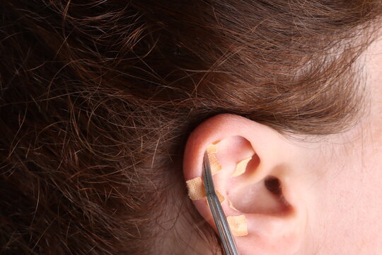 Auriculotherapy Seeds in a blue background