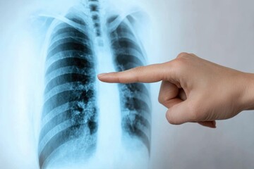 Human hand pointing at chest x-ray image of adult lungs for medical analysis