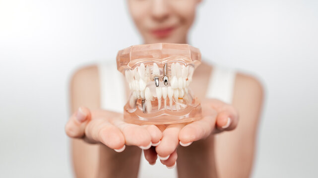 Doctor shows patient educational model of dental implant in clinic, close-up. White healthy perfect teeth plastic model. Implants, maxillary sinus lift, educational and explanatory materials, ads