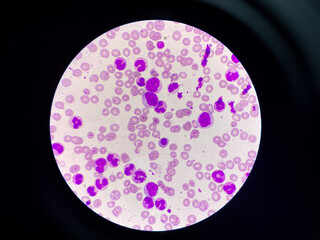 With blood cell in blood smear.