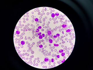 With blood cell in blood smear.