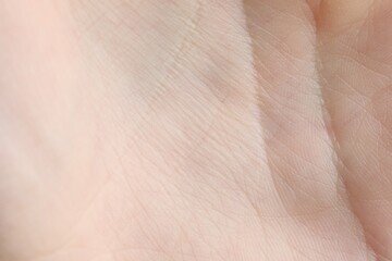 Naklejka premium Texture of dry skin as background, closeup