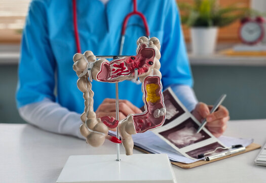 Doctor examines digestive system model and ultrasound image