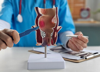 Doctor is holding scalpel anatomy of rectum problem