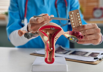 Model of the female reproductive system of the uterus and birth control pills for women