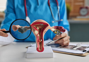 Doctor with Uterus and Ovaries anatomy model and magnifying glass.