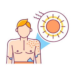 sunburn vector icon, sunburn vector illustration - simple illustration of sunburn, perfect for logos,and sunburn -themed designs.