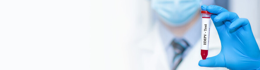 Doctor holding a test blood sample tube with Human metapneumovirus virus test. Human...