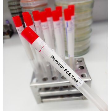 Nasal swab sample for Reovirus Test, Sedoreoviridae. RNA virus, 