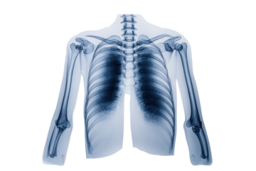 Detailed X-ray of human chest and shoulder region showing bones and lungs in a clinical setting