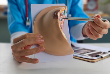 Doctor explains disease and uses anatomical model of breast concept