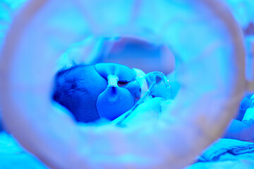 Closeup lovely little newborn baby infant lying in incubators for newborns, Newborn baby having the...