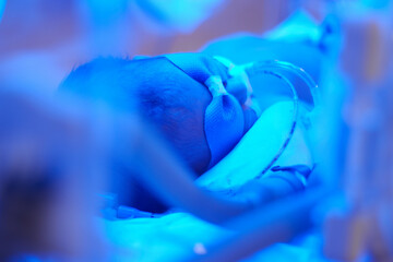 Closeup lovely little newborn baby infant lying in incubators for newborns, Newborn baby having the...