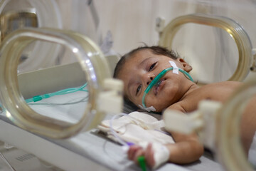 Closeup lovely little newborn baby infant lying in incubators for newborns, Newborn baby having the...