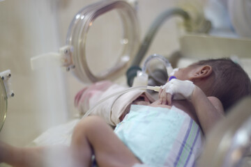 Closeup lovely little newborn baby infant lying in incubators for newborns, Newborn baby having the...