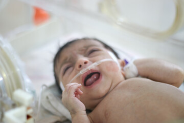 Closeup lovely little newborn baby infant lying in incubators for newborns, Newborn baby having the the breathing problem after birth, newborn in NICU, Neonatal intensive care unit.