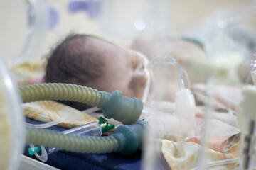 Closeup lovely little newborn baby infant lying in incubators for newborns, Newborn baby having the the breathing problem after birth, newborn in NICU, Neonatal intensive care unit.