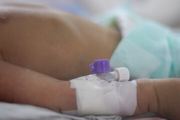 Closeup lovely little newborn baby infant lying in incubators for newborns, Newborn baby having the the breathing problem after birth, newborn in NICU, Neonatal intensive care unit.