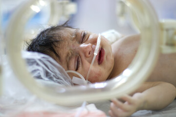 Closeup lovely little newborn baby infant lying in incubators for newborns, Newborn baby having the the breathing problem after birth, newborn in NICU, Neonatal intensive care unit.