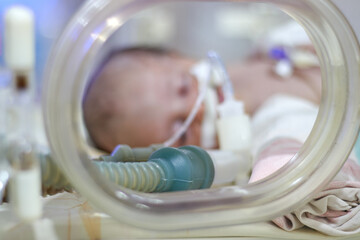Closeup lovely little newborn baby infant lying in incubators for newborns, Newborn baby having the...