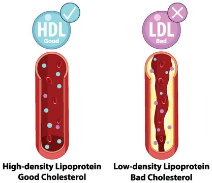 Cholesterol Types: HDL vs LDL