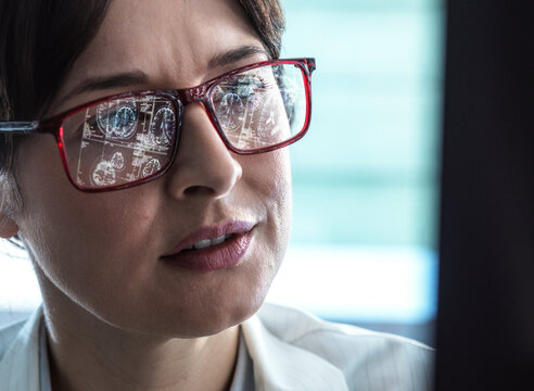 Doctor viewing a patients MRI Brain scan for ageing and damage due to dementia and Alzheimer's disease