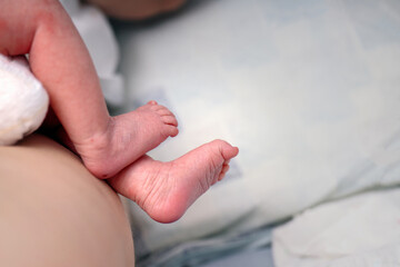 baby's feet showcasing delicate wrinkles and a small dark mark on the heel from genetic screening,...