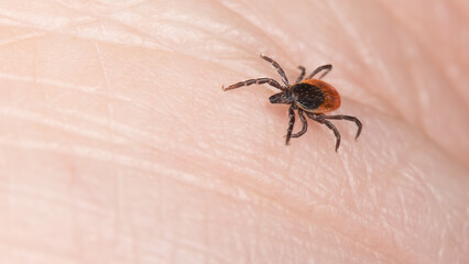 Dangerous deer tick parasite on a human skin background. Ixodes ricinus or scapularis. Close-up of disgusting parasitic mite, insect carrier of tick-borne diseases as Lyme borreliosis or encephalitis.
