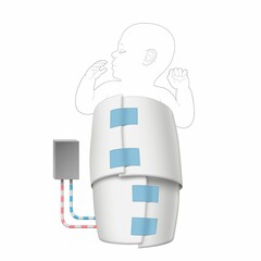 Illustration of neonate being cooled with a special blanket, hypothermia as a treatment for hypoxic ischemic encephalopathy