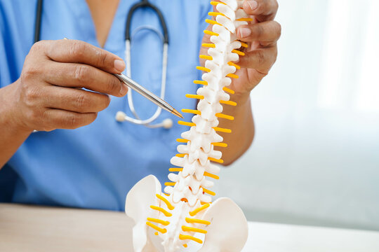 Asian doctor holding spinal nerve and bone model, Lumbar spine displaced herniated disc fragment for treatment medical in the orthopedic department.