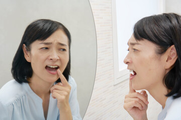 歯の悩み　50代の女性