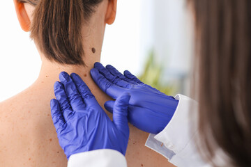 Dermatologist examining moles on woman's neck in clinic, closeup