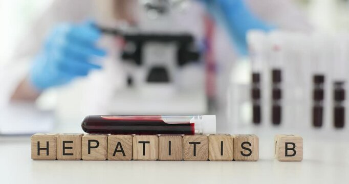 Process of testing for hepatitis B using a blood sample in laboratory