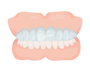 歯科マウスピース